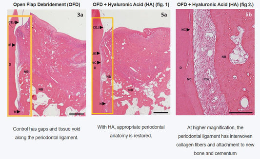 PerioVive | Hyaluronic acid gel